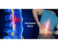 Reliable Disc Herniation Chiropractor | free-classifieds-usa.com - 1