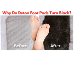 Why Do Detox Foot Pads Turn Black? | free-classifieds-usa.com - 1