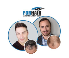 FORHAIR Hair Transplant Clinic | free-classifieds-usa.com - 1