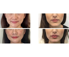 Dr. Susan Tan | Hawaii Facial Plastic Surgery, Honolulu Hawaii | free-classifieds-usa.com - 1
