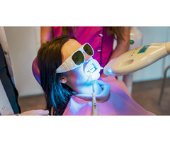 Teeth Whitening in San Diego | free-classifieds-usa.com - 1