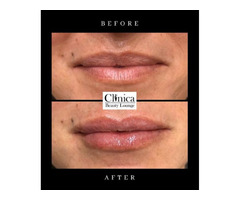 Transform at Our Laser Medical Spa | free-classifieds-usa.com - 1