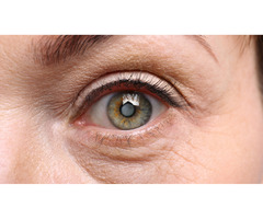 Consult Griffey Eye Care for Cataract Surgery in Chesapeake | free-classifieds-usa.com - 1