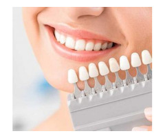 Teeth Whitening in Homestead | free-classifieds-usa.com - 1