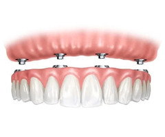 Ditch the Dentures, Restore Your Bite: Life-Changing Dental Implants in Lehighton  | free-classifieds-usa.com - 1