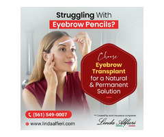 Forget Brow Fillers & Get an Eyebrow Transplant in Boca Raton | free-classifieds-usa.com - 1