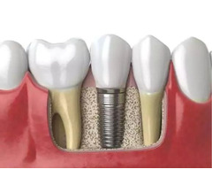 Premium Dental Care Services in Ventura: Your Smile's Best Companion | free-classifieds-usa.com - 1