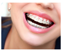 Transform Your Smile with Leading Orthodontics and Invisalign Treatment in Overland Park | free-classifieds-usa.com - 1
