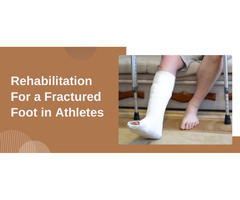 Rehabilitation For a Fractured Foot in Athletes - Urgent Care for Feet | free-classifieds-usa.com - 1