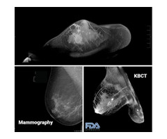 Painless Mammograms with Koning 3D Breast Imaging | free-classifieds-usa.com - 2