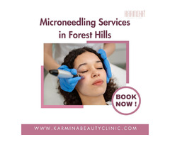 Microneedling Services in Forest Hills | free-classifieds-usa.com - 1