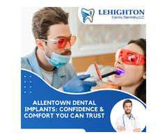 Allentown Dental Implants: Confidence & Comfort You Can Trust | free-classifieds-usa.com - 1