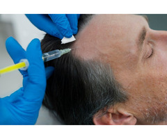 Hair Restoration Treatment Sacramento | free-classifieds-usa.com - 1