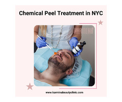 Chemical Peel Treatment in NYC | free-classifieds-usa.com - 1