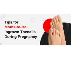 Tips for Moms-to-Be: Managing Ingrown Toenails During Pregnancy | free-classifieds-usa.com - 1