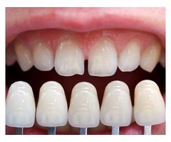 Somerset Dental | free-classifieds-usa.com - 1